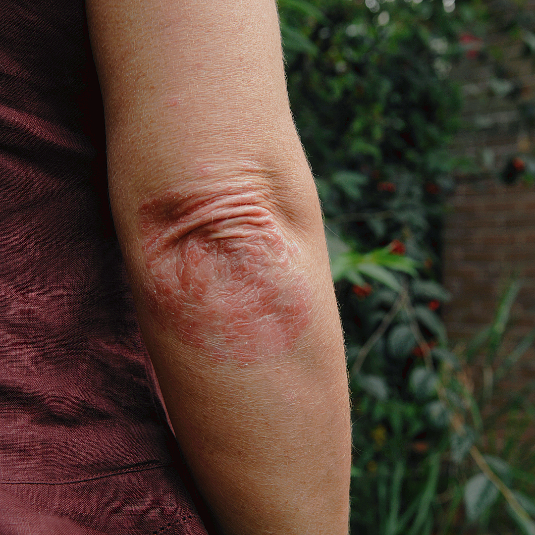 Stay Wild Apothecary - Wholesale Healing Salve/Balm/Cream - Overnight Healing Balm for Eczema, Psoriasis, and Extra Dry Skin2