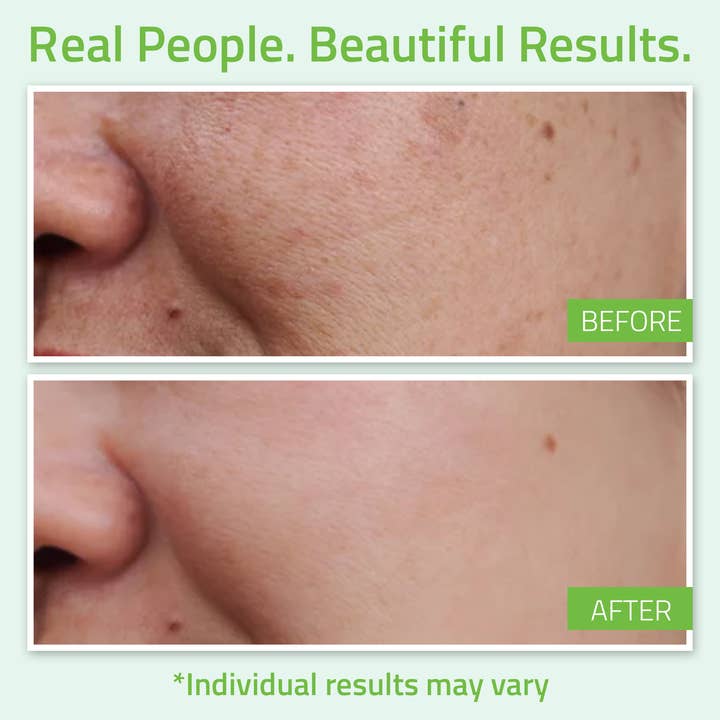 yeouthskincare - Wholesale Gezichtsserum/concentraat - YEOUTH Hyaluronzuur Serum met Vitamine C & Tripeptide 60ml2