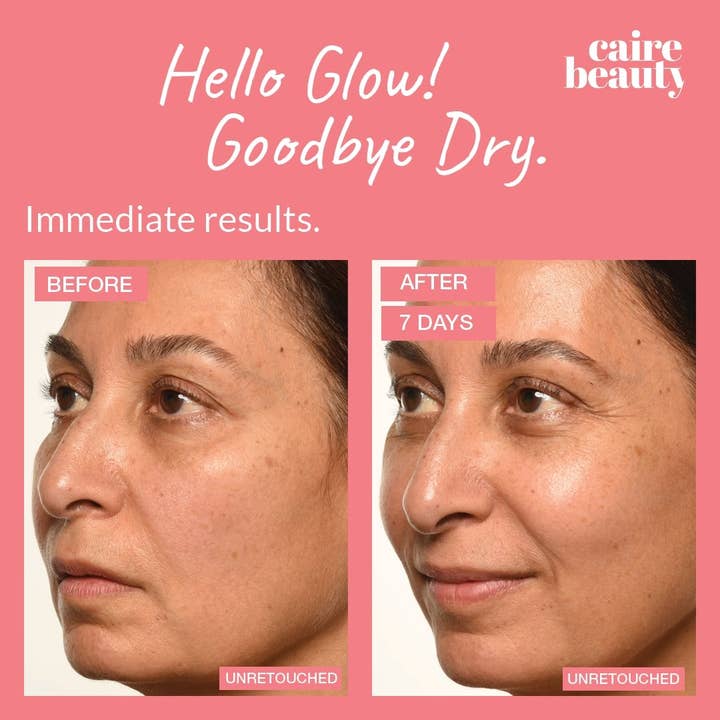 Caire Beauty - Wholesale Facial Serum/Concentrate - Theorem Serum Boost10