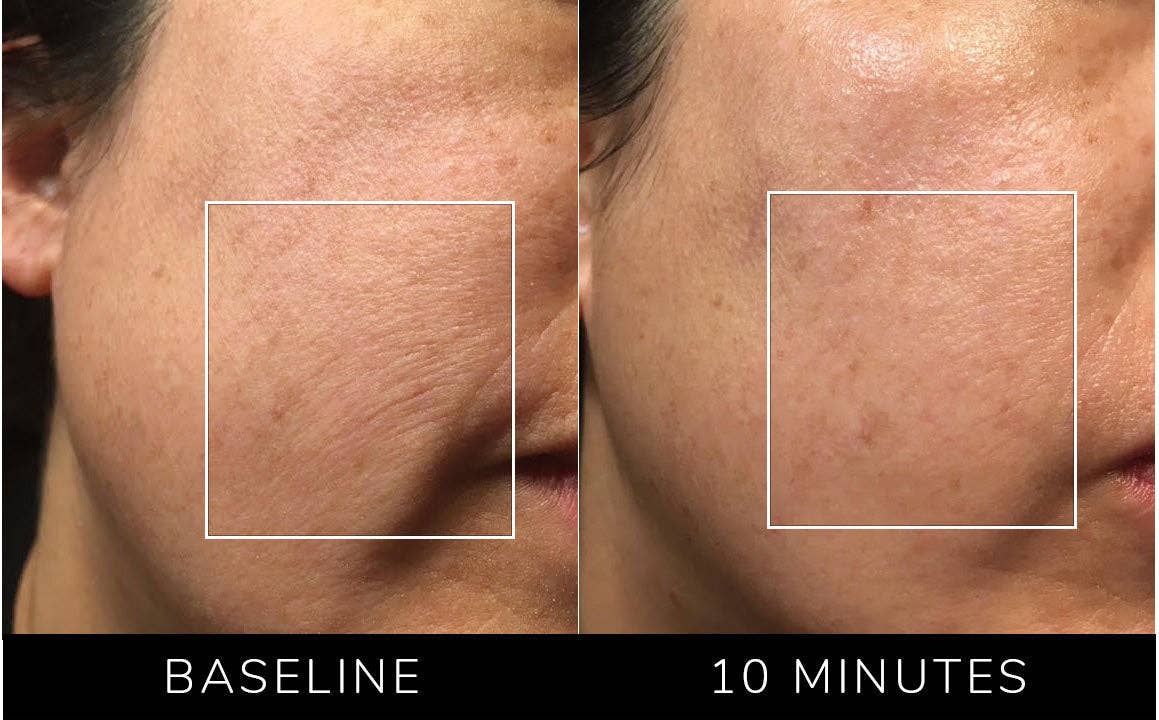 Nature Checkout Inc - Wholesale Electronic Skincare Device - Eno Patented All-In-One Skincare Device. The one device that does it all - exfoliation;  product infusion & facial sculpting12