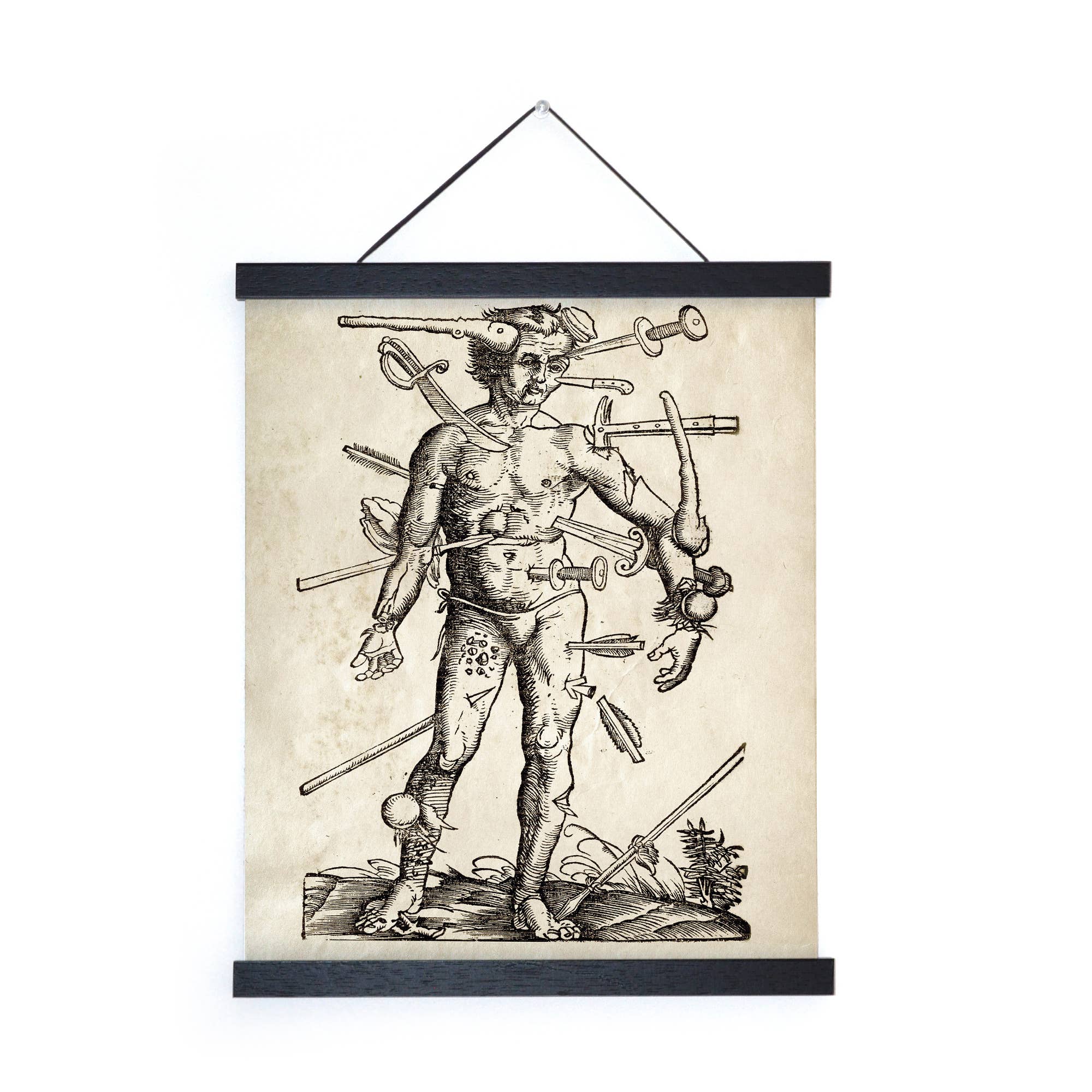 Curious Prints - Wholesale Art Print - Vintage Anatomy Wounded Man Print w/ optional frame2