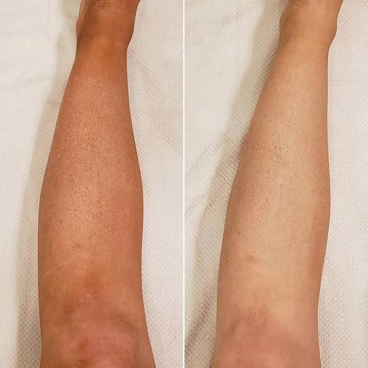 Beettan LLC - Wholesale Self-Tanner - BEETOFF- Self Tanning Eraser3