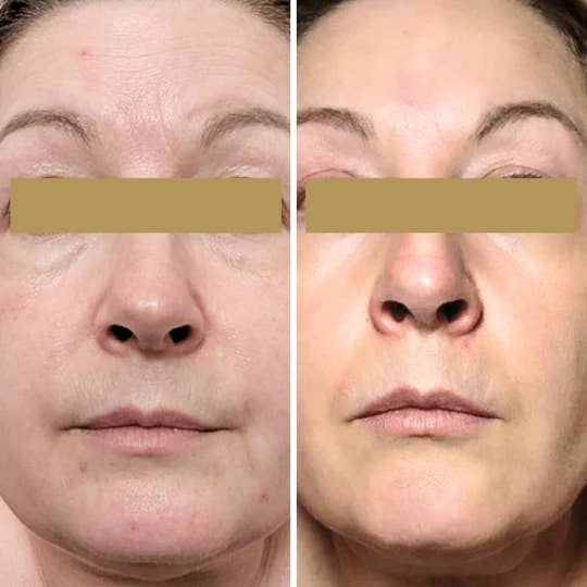DERMEDEN - Wholesale Anti-aging moisturizer - 4-in-1 dagcrème Global Action Droge huid SPF 50