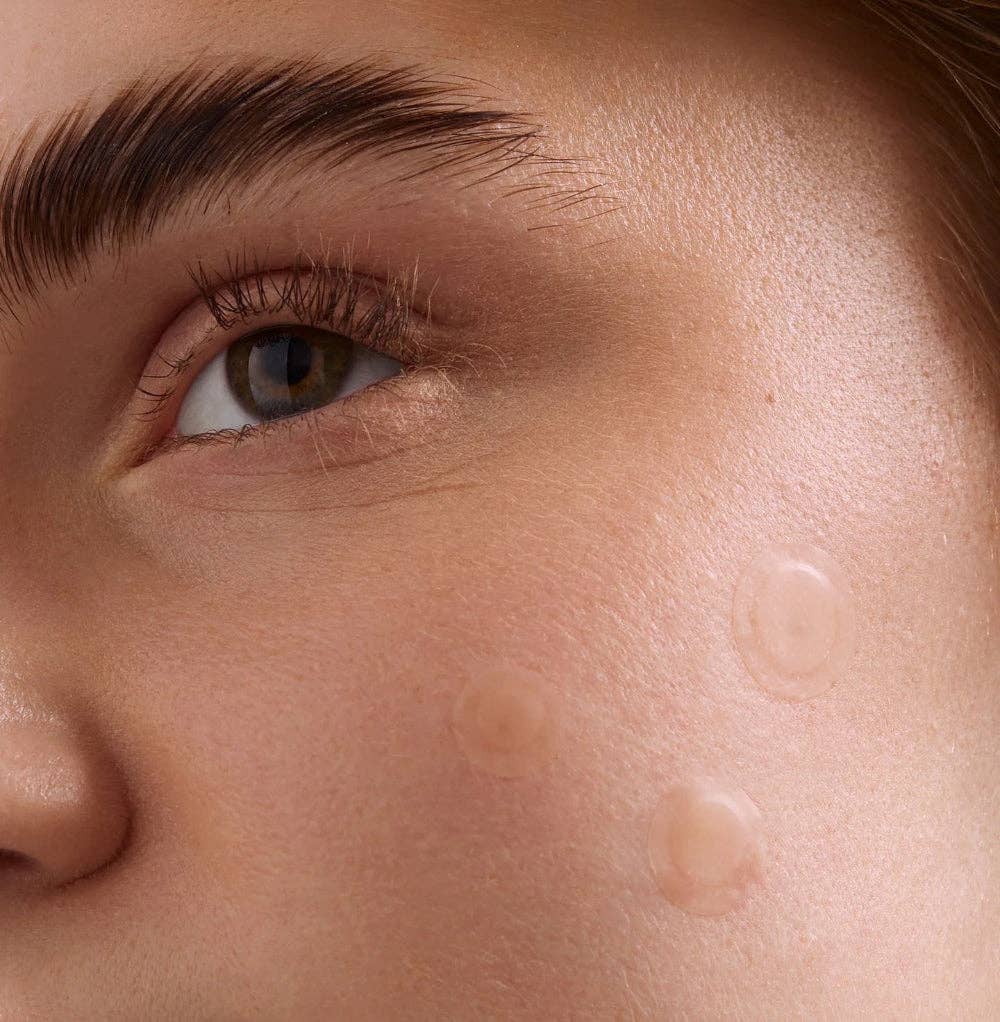 Practical Alchemy - Wholesale Acne/Hydrocolloid Patch - VANISHING PIMPLE PATCHES1