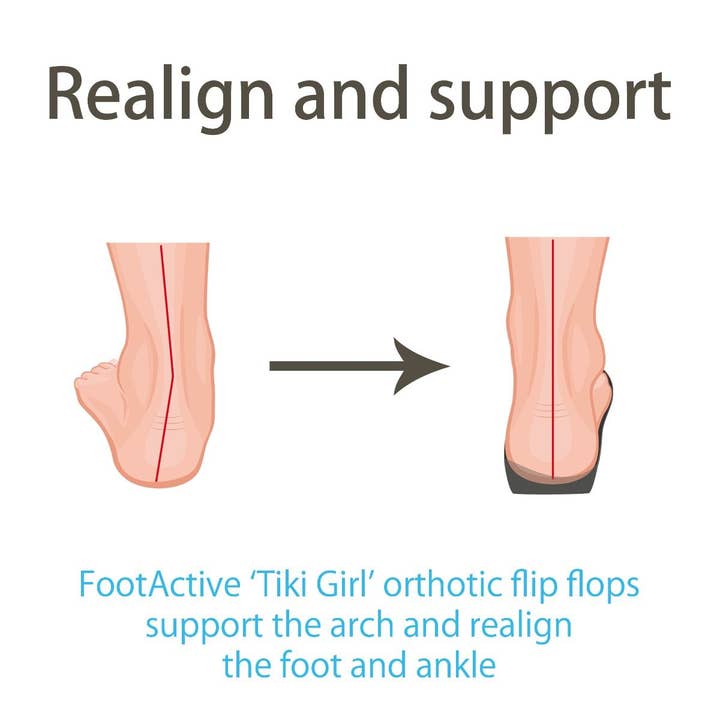 FootActive - Wholesale Flip Flops - Women's - FootActive Tiki Girl Orthotic Flip Flops