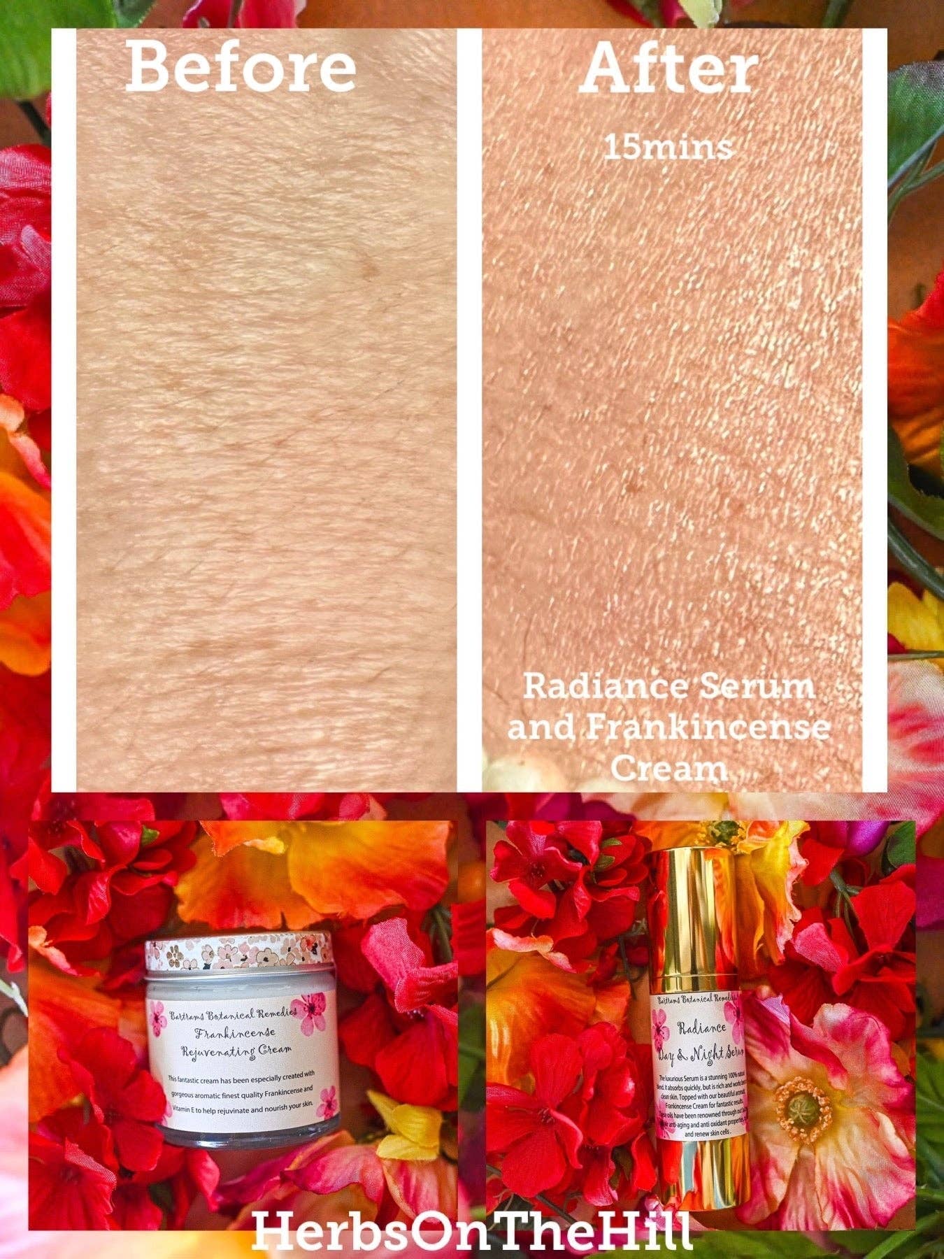 Herbs On The Hill – wholesale Facial moisturiser – Radiance Day & Night Serum (18ml)| Herbs on the Hill | | Herbs on the Hill1