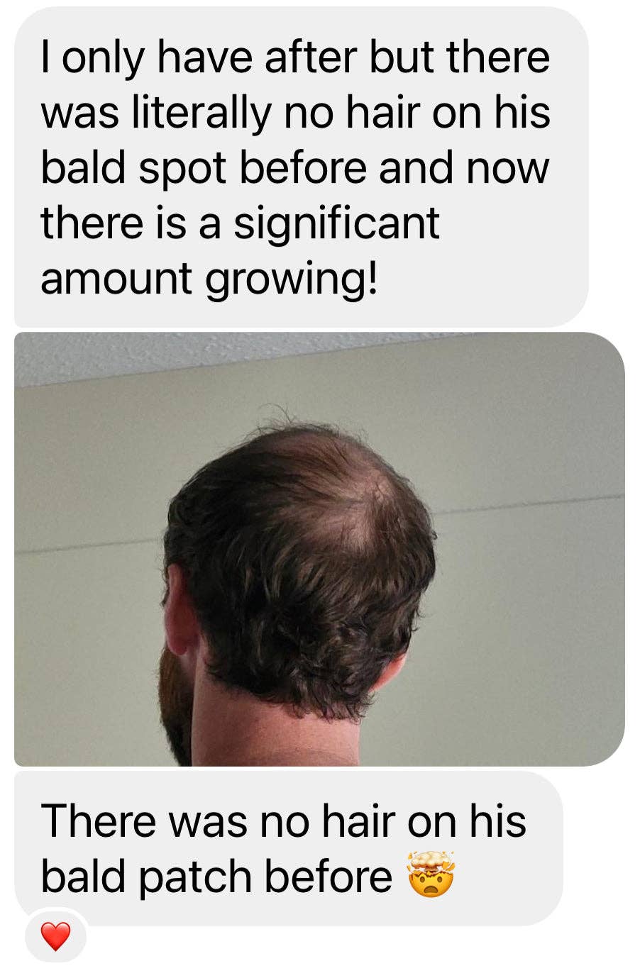 Sutton Michelle Designs - Wholesale Hair Oil - Growth Scalp Oil13