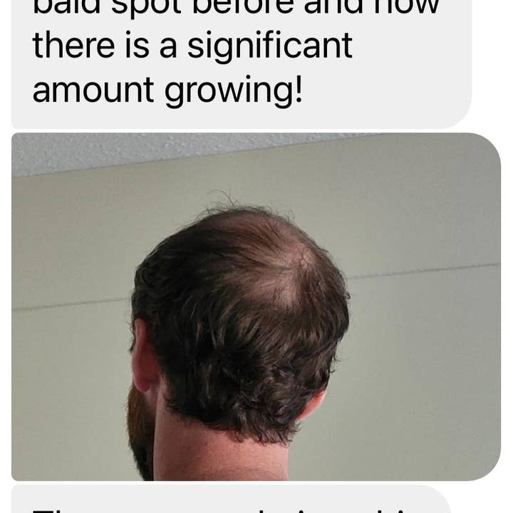 Sutton Michelle Designs - Wholesale Hair Oil - Growth Scalp Oil13