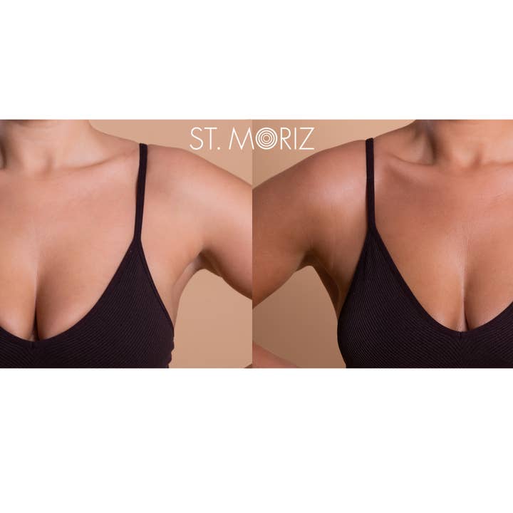 BLIII Holding - Wholesale Self-Tanner - St. Moriz Professional Fast Tanning Mousse2