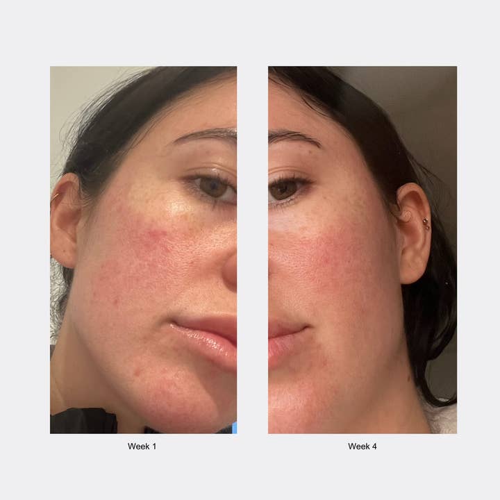 Foile - Wholesale Facial moisturiser - Daily Jelly Moisturiser6