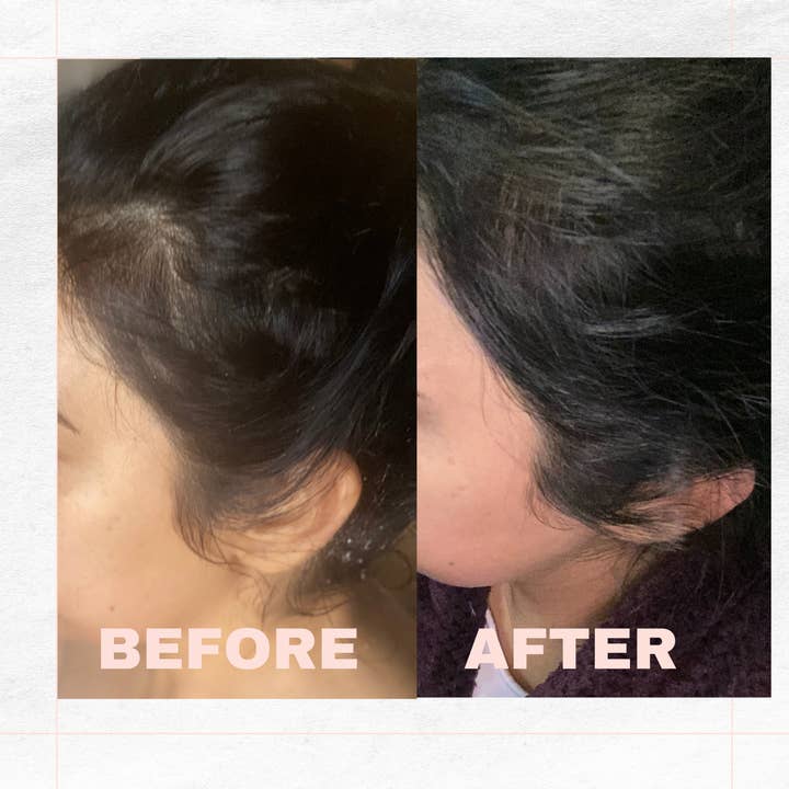 Hair Loving - Wholesale Hair Oil - Beauty Renewal - Nourishing Hair Growth for All Hair Types