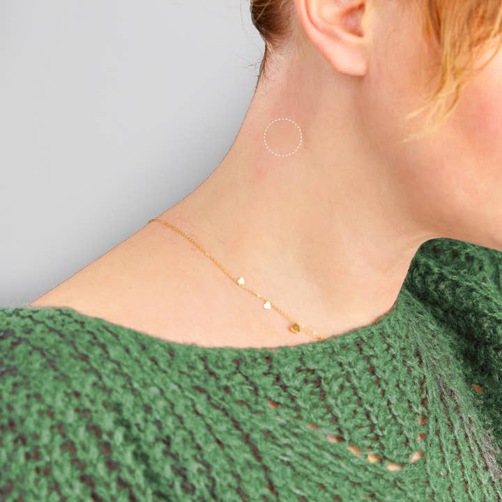 MaterNatura - Wholesale Hair Thinning/Loss Treatment - Hair loss-prone scalp patch2