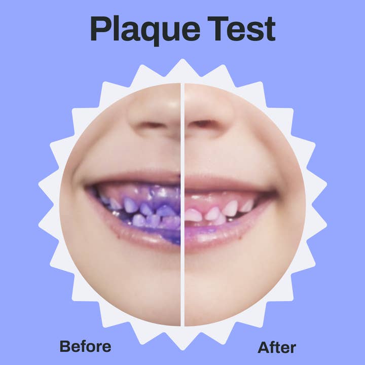 AutoBrush - Wholesale Toothbrush – Kids & Baby - autobrush Sonic Pro Kids - ADA-Accepted U-shaped Toothbrush6