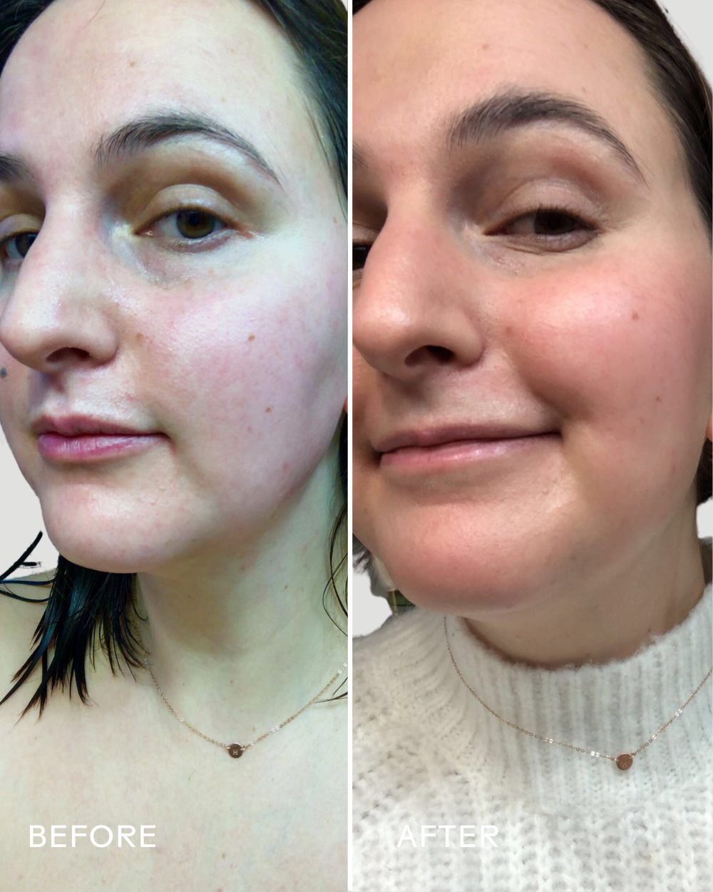 Three Ships (No Duties | Ships from US/CA | USMCA Compliant) - Wholesale Facial Serum/Concentrate - SkinHero™ Calendula + 2% Bakuchiol Bio-Retinol Serum5