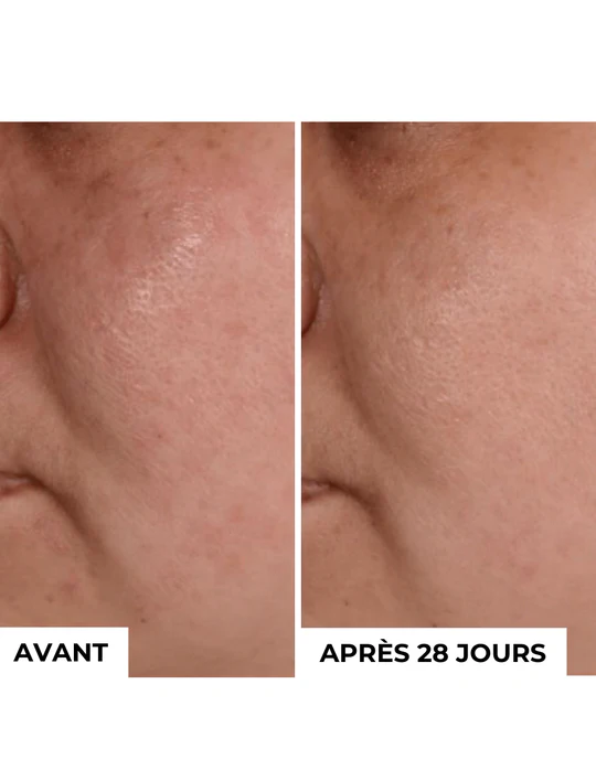 DERMEDEN - Wholesale Skincare Face Mask - Exfoliating Mask Detox 2 in 13