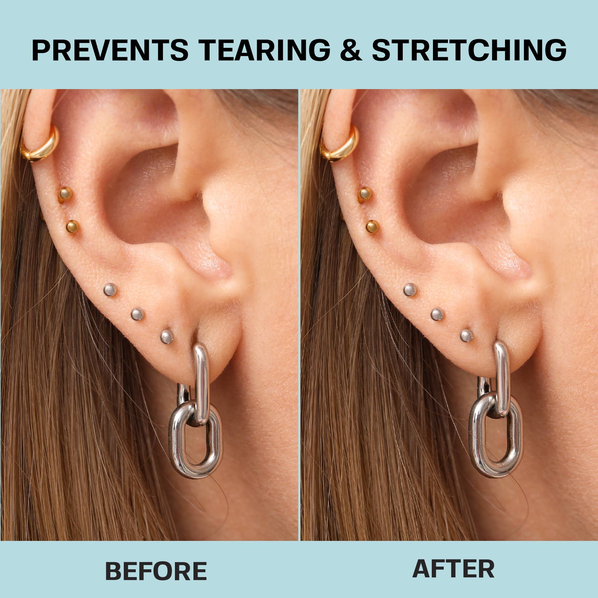 Base Laboratories - Wholesale Bandaids/Bandages - Ear Lobe Support Patches - For Heavy Earrings & Repair3