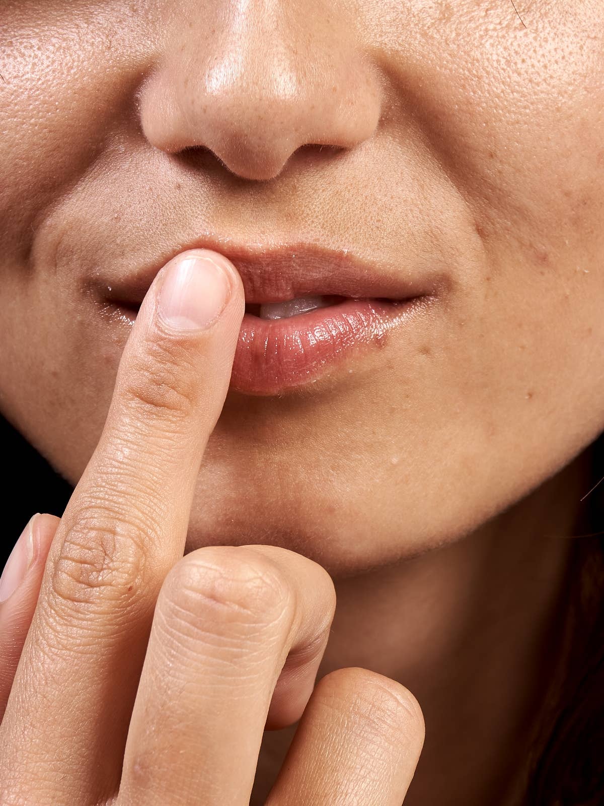 SoKind - Wholesale Nipple Cream - Maternity - Pure Kindness Repairing Multi-product5