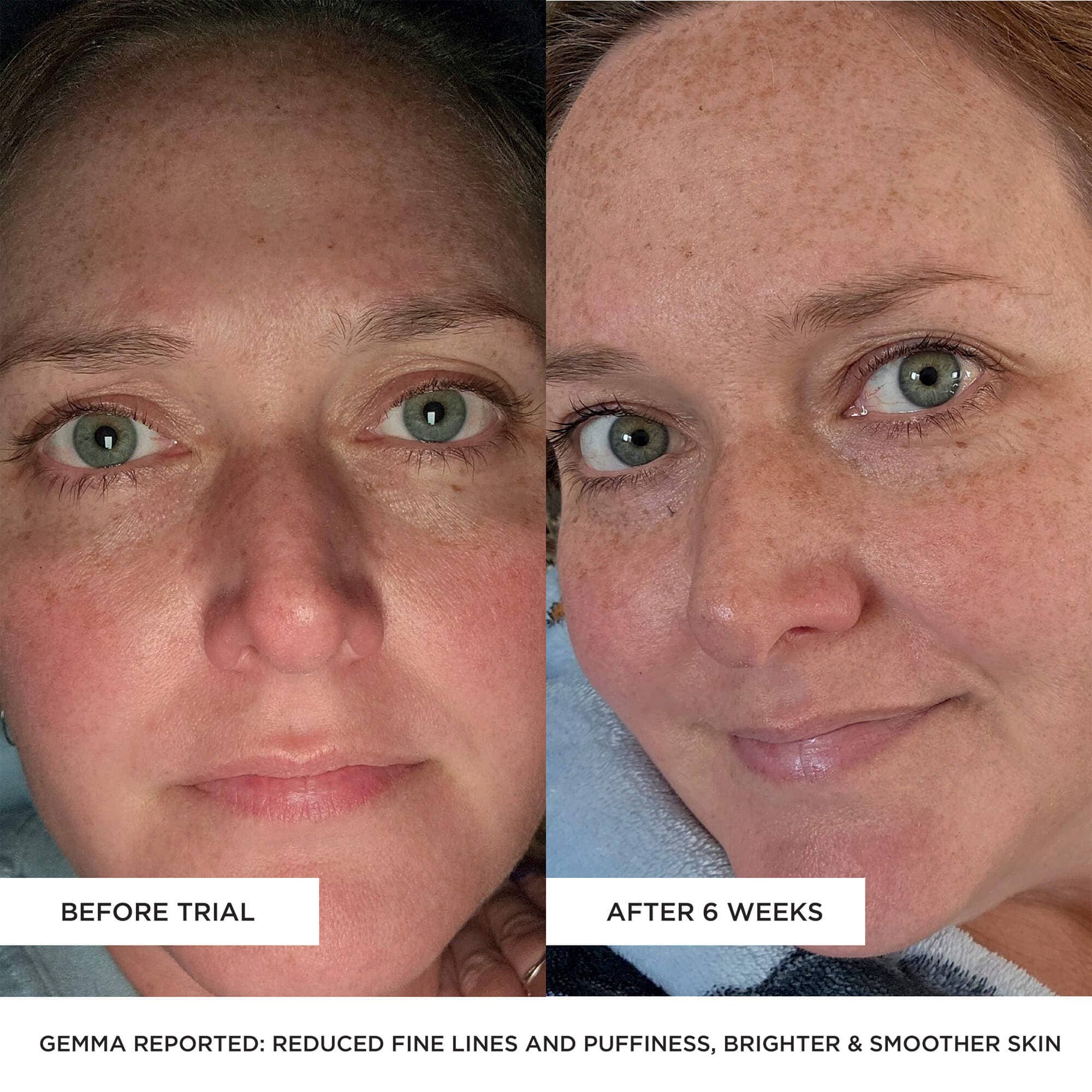 BEAUTYPRO – wholesale Electronic skincare device – LED Wand - 5 in 1 Anti-Ageing Device7