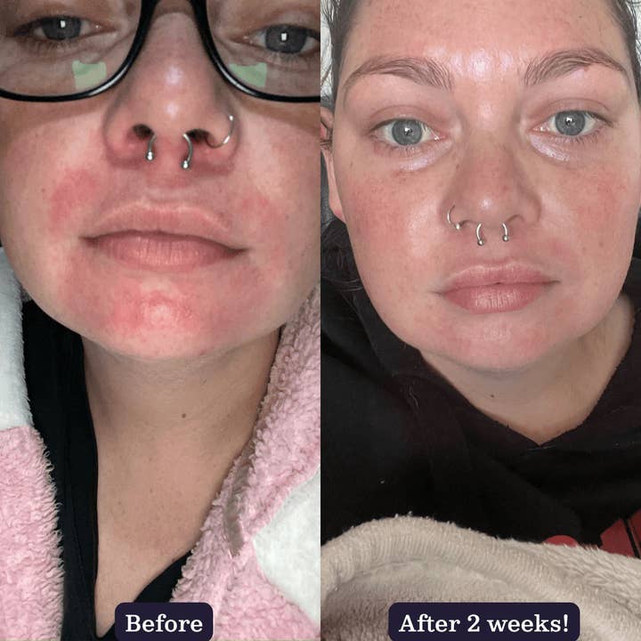 Edible Beauty Australia - Wholesale Facial oil - & Snowflower Illuminating Face Oil2