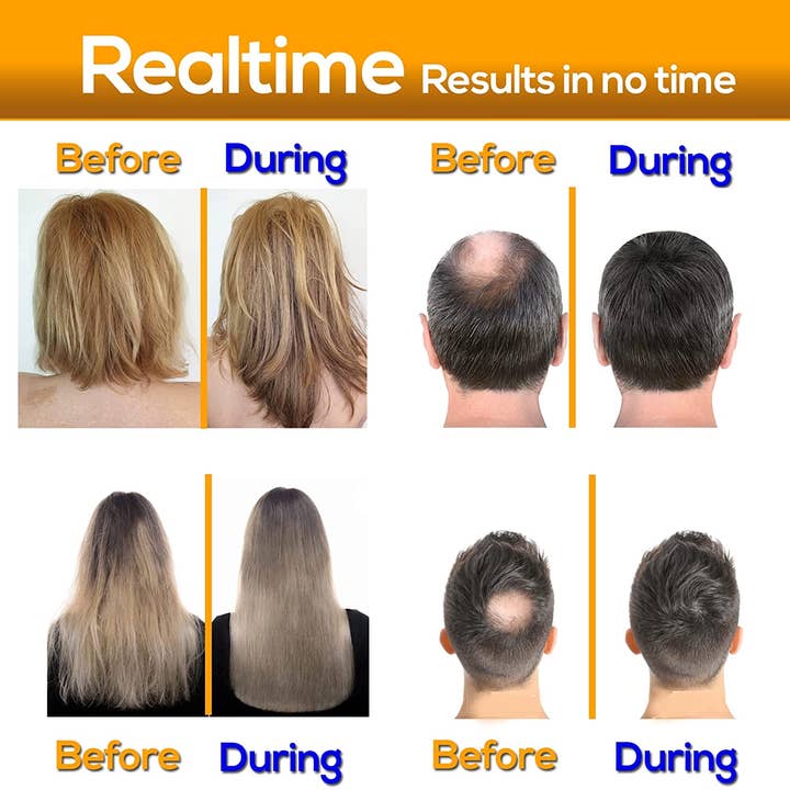 AMMURI – wholesale Hårschampo – Biotin schampo för håravfall - män hårväxt schampo - Hai4