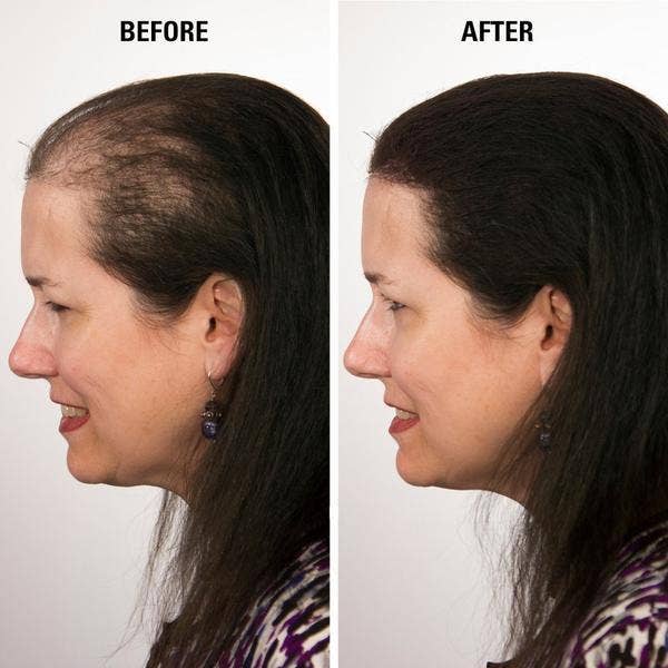 My Wholesale Warehouse - Wholesale Hair Thinning/Loss Treatment - Volumon Hair Building Fibres - KERATIN 12g
