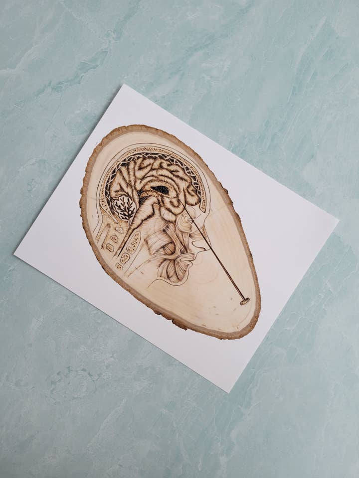 The Lobotomist - Fine Art Primt for wholesale by Unstrung Studios