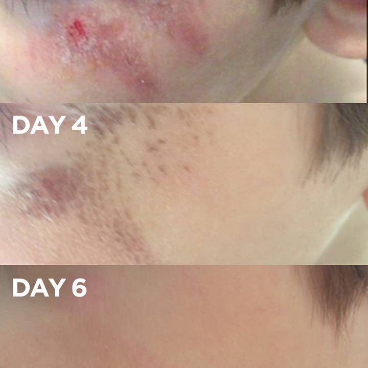 Lanolips - Wholesale Healing Salve/Balm/Cream - Golden Dry Skin Miracle Salve - 25g4