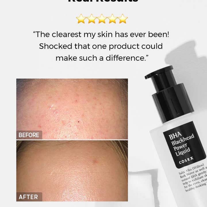 Best Beauty Group - Wholesale Facial Exfoliant/Scrub - COSRX BHA Blackhead Power Liquid Kbeauty Acne Treatment5