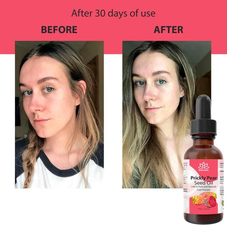 Relaxcation - Wholesale Bath/Body Oil - Prickly Pear Seed Oil5