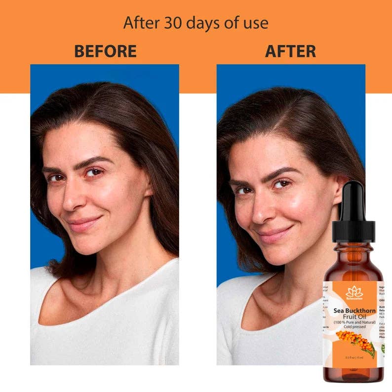 Relaxcation - Wholesale Essential Oil - Organic Sea Buckthorn Essential Oil7