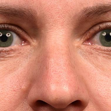 SilcSkin – wholesale Eye treatment mask – SilcSkin Eye Pad-Single Set