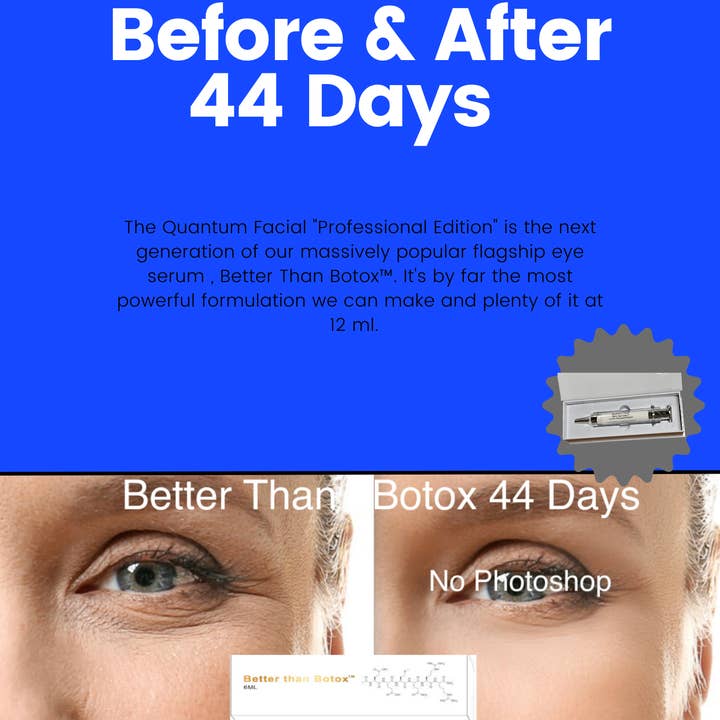 NABulous - Wholesale Anti-aging moisturiser - Better than Botox™ Anti-Aging Serums Under Eye Wrinkles, Forehead and Professional Edition41