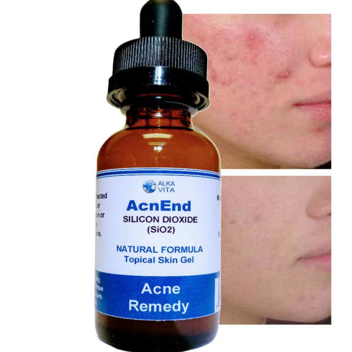 AlkaVita - Wholesale Acne/hydrocolloid patch - Cystic Acne Remedy AcnEnd Gel Silicon Dioxide Fast Results1
