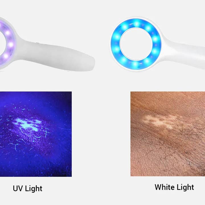 IBOOLO – Brinquedo de madeira - Crianças por atacado – IBOOLO candeeiro de madeira DE-315 UV 365nm & UV405nm luz violeta dermoscopia candeeiro de madeira veterinário5