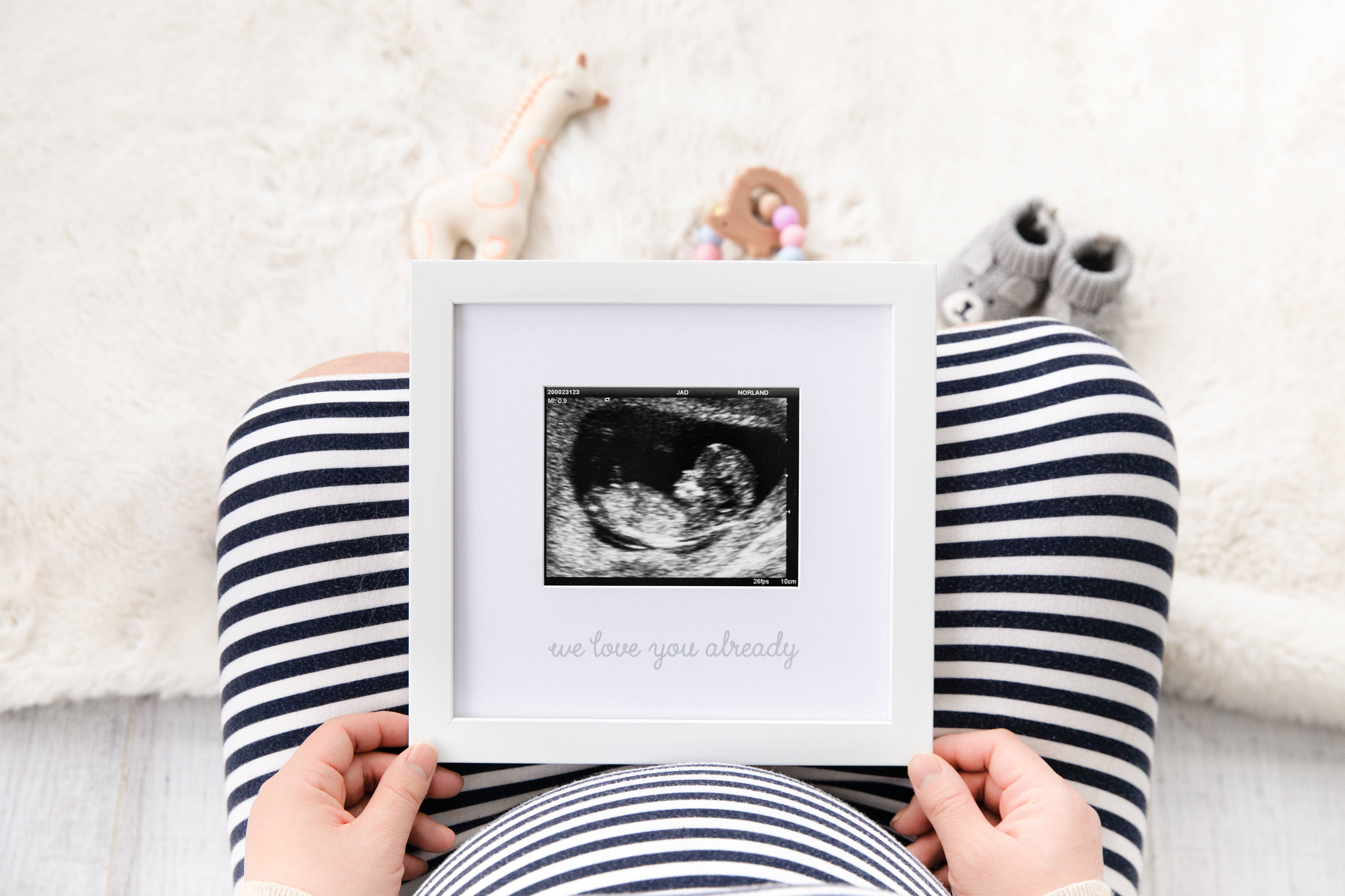 Kate & Milo - Wholesale Picture Frame - Kids & Baby - We Love You Already Sonogram Frame, White2