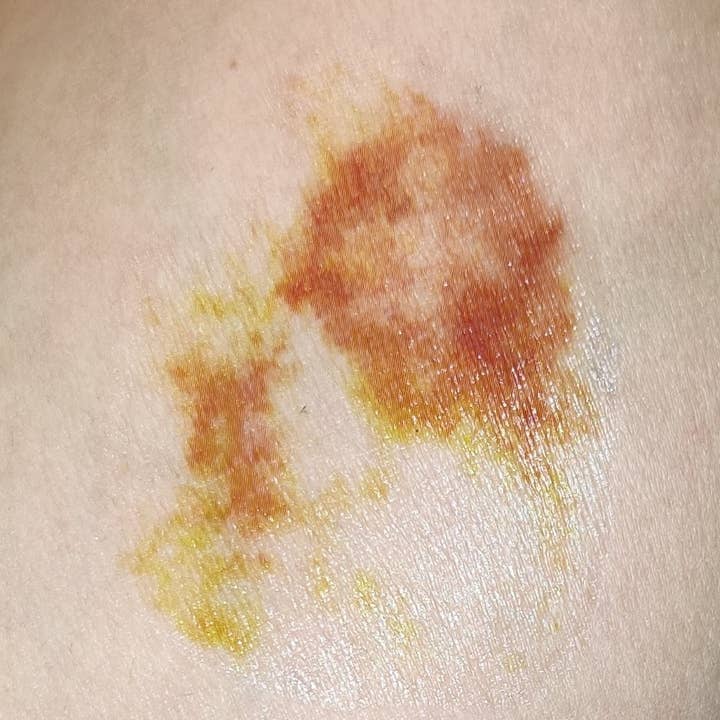 TATUAGEM DE HEMATOMA GRANDE (A) por atacado de DESIRED FX