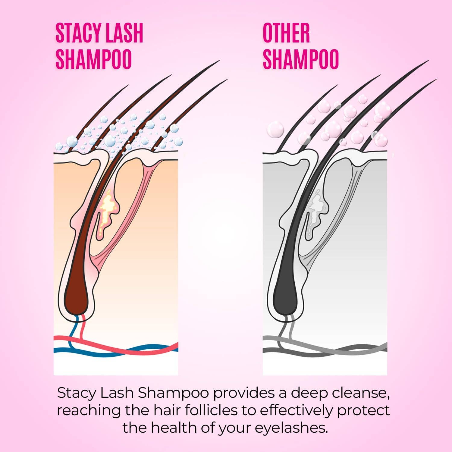 Stacy Lash – cílios postiços por atacado – Kit de Shampoo Espumante para Cílios com Escovas Spoolies4