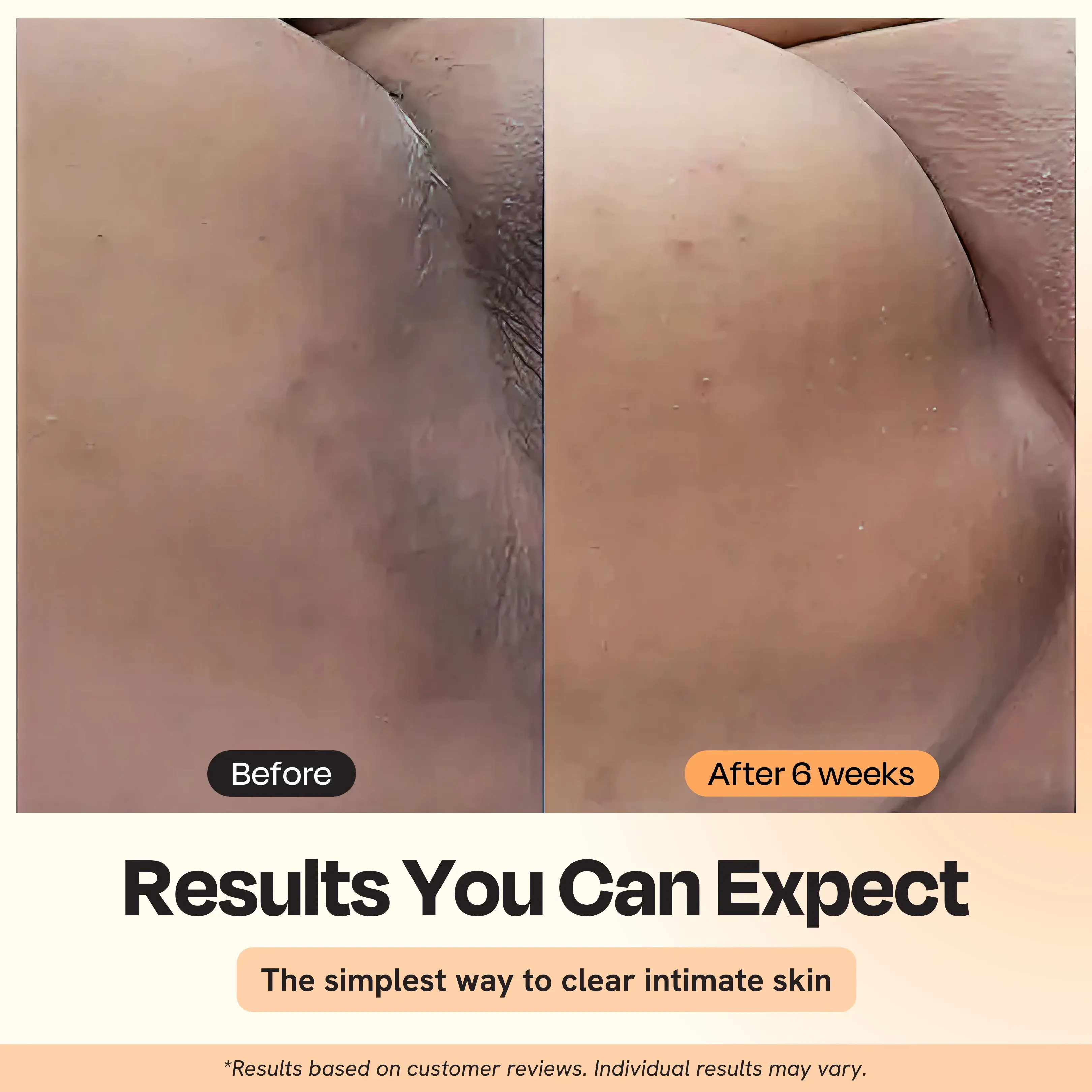 Gleamin - Wholesale Intimate Cleanser/Wipe - Illuminating Intimate Serum
4