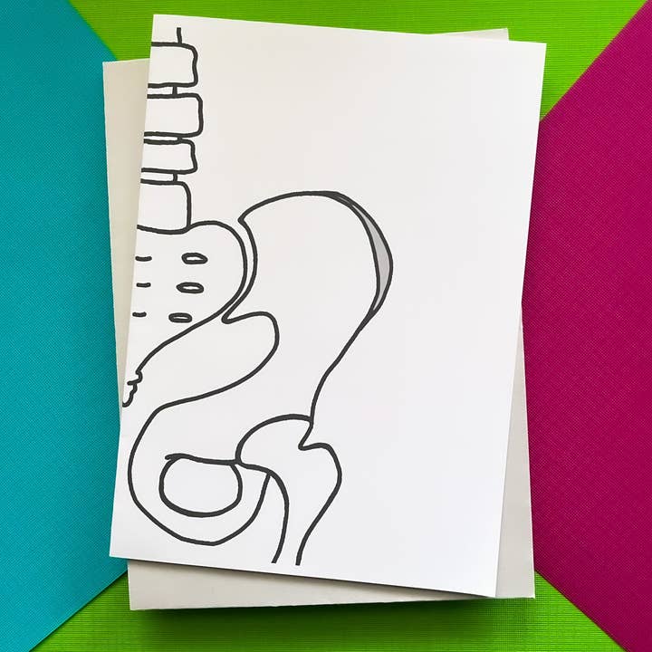 Scheda di Sostituzione dell'Anca di StoneDonut Design per la vendita all'ingrosso da parte di Stone Donut Design, LLC