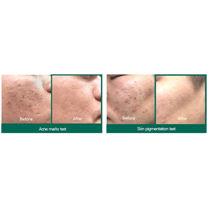 SKEEN - Wholesale Anti-Aging Moisturizer - SOMEBYMI Snail TrueCICA Miracle Repair Cream 60g1