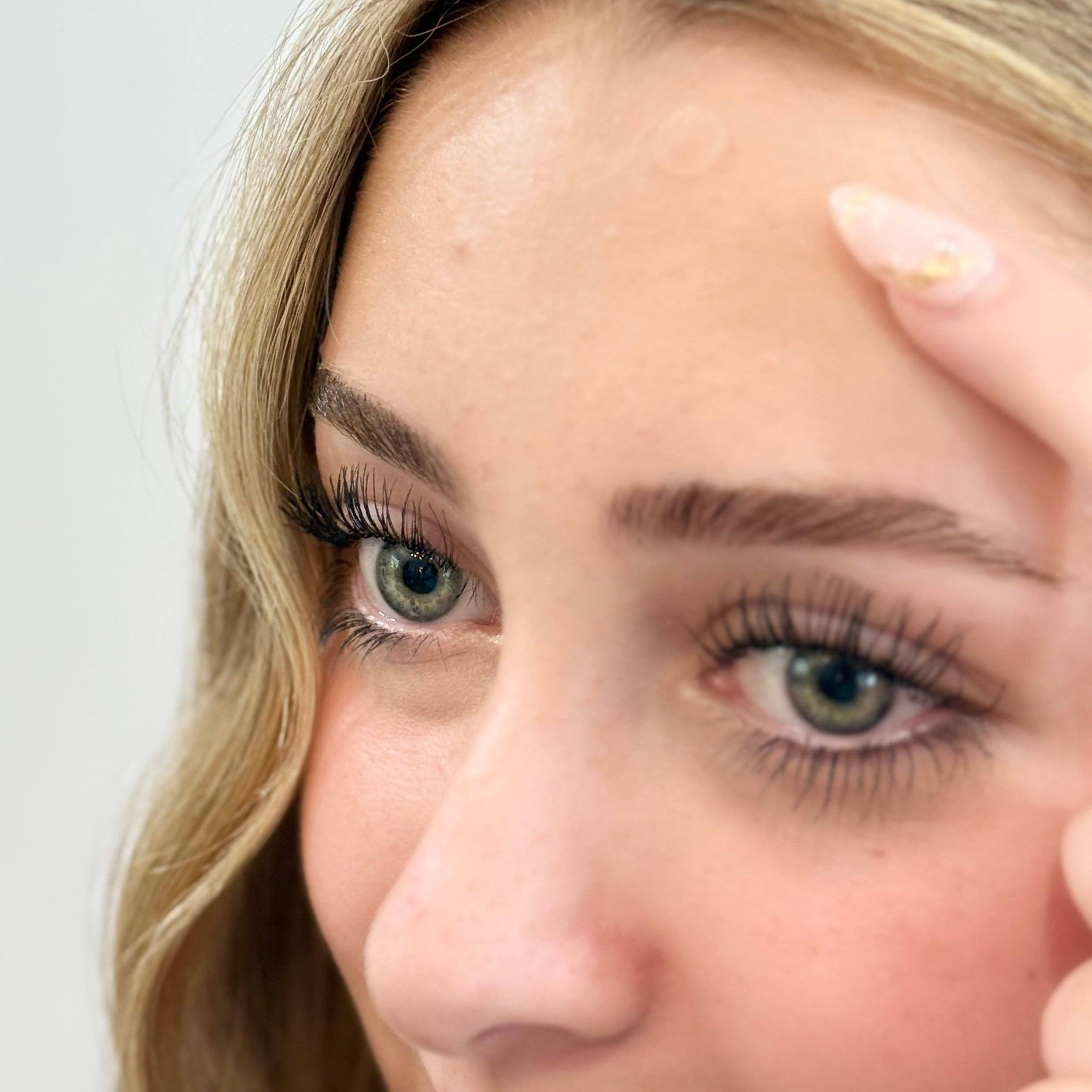 My Flexy - Wholesale Acne/Hydrocolloid Patch - Pimple Patches5