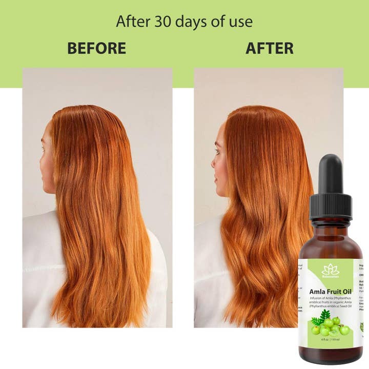 Relaxcation - Wholesale Hair Oil - Amla Fruit Oil2