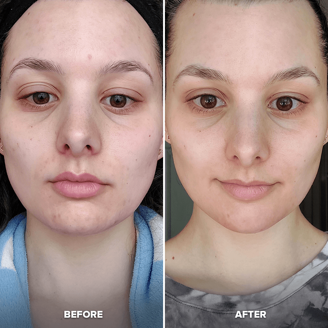 Contour Cube - Wholesale Face/Beauty Roller - Contour Cube Mini2