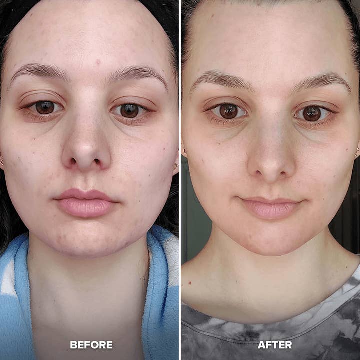 Contour Cube - Wholesale Face/Beauty Roller - Contour Cube Mini2