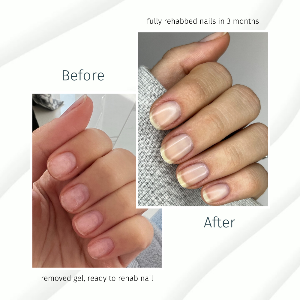 Duri Cosmetics - Vente Vernis à ongles - Système de croissance des ongles Rejuvacote 1 Original à résistance maximale, base et couche de finition6