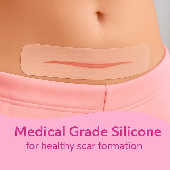 Ninja Mama – Engroshandel Creme til ar – Ninja Mama gennemsigtige silikonearstrimler til kejsersnit - pakke med 66