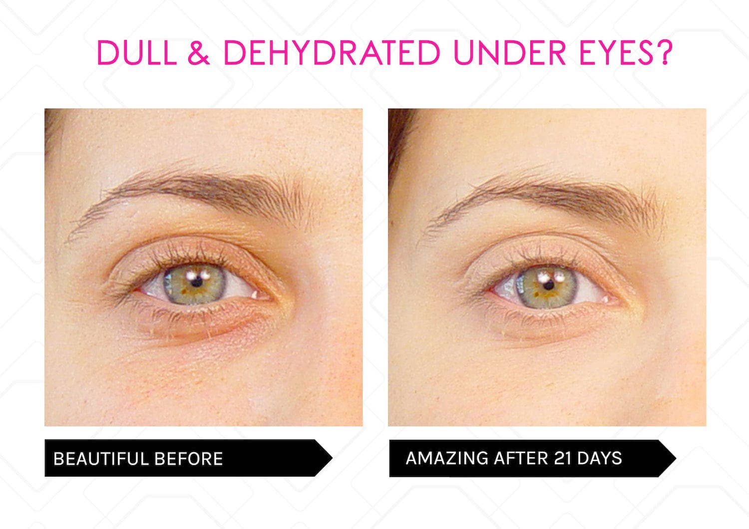 Mirenesse - Wholesale Skincare Face Mask - Skin Secrets Red LED Mask, 7 in 1 Treatments22