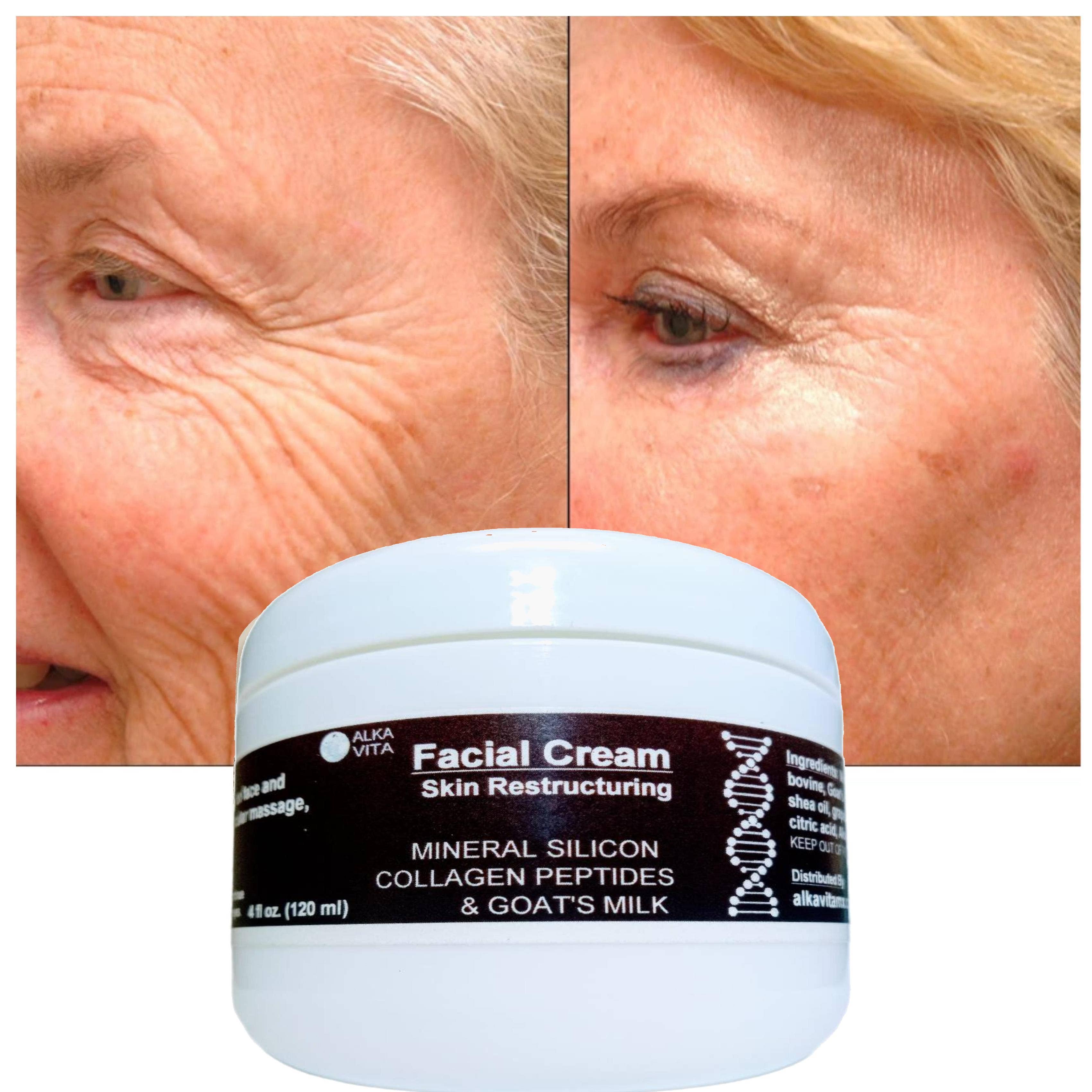 AlkaVita – Großhandel Anti-Aging-Feuchtigkeitscreme – Gesichtscreme Silikon-Kollagen-Peptid-Hautfaltenbehandlung3