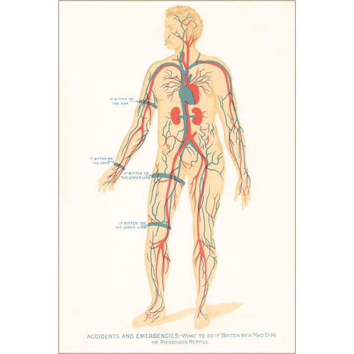 Found Image Press - Wholesale Magnet - Magnet AY-34 Where to Put the Tourniquet