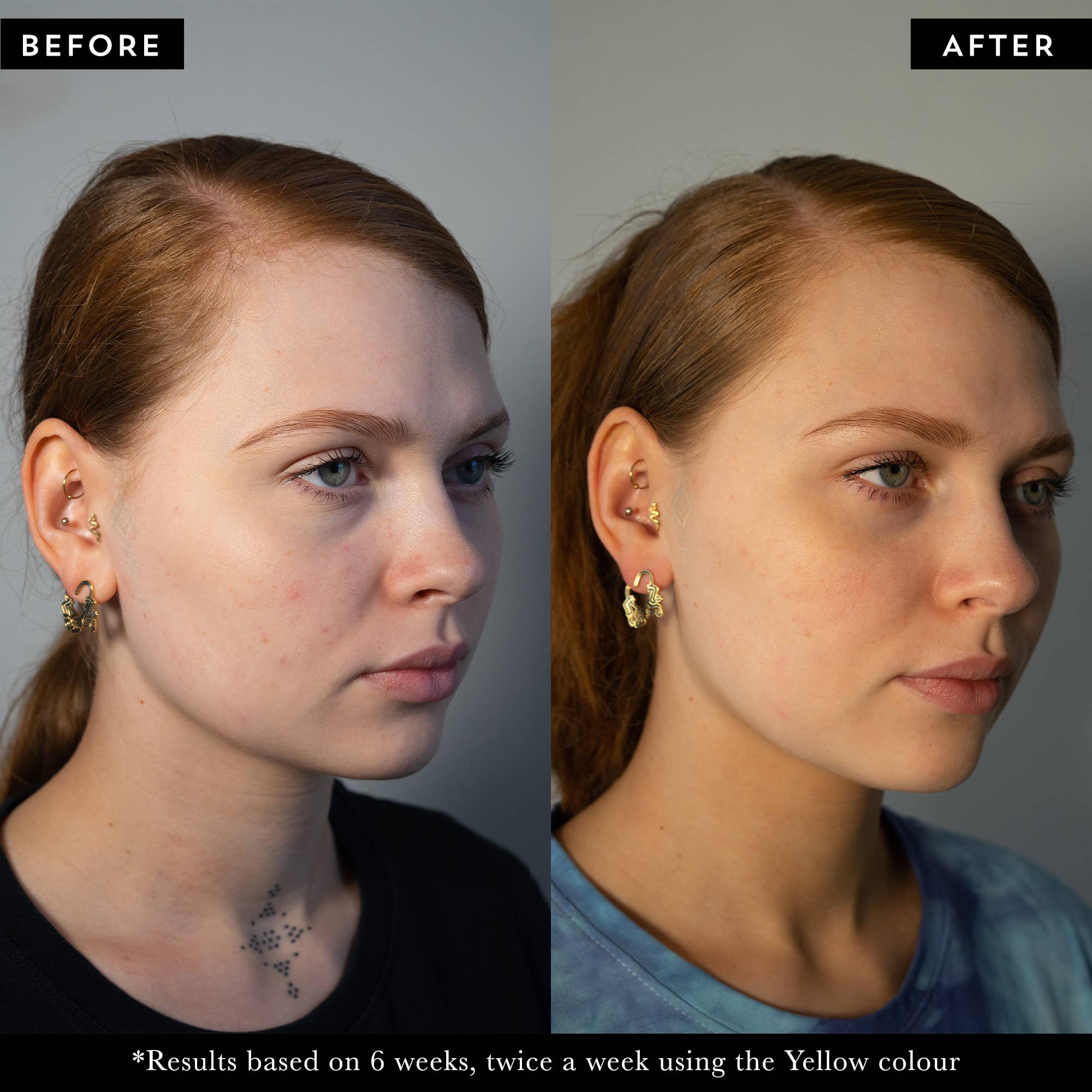 +maskology +serumology – wholesale Electronic skincare device – PHOTON LED Mask | Beauty Devices | Salon & Spa6